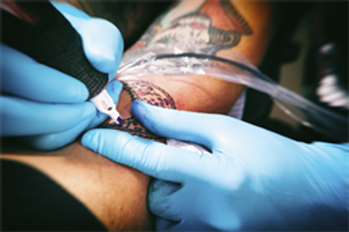 Tattoo Regrets Laser Tattoo  Star Beauty Mauritius  Facebook